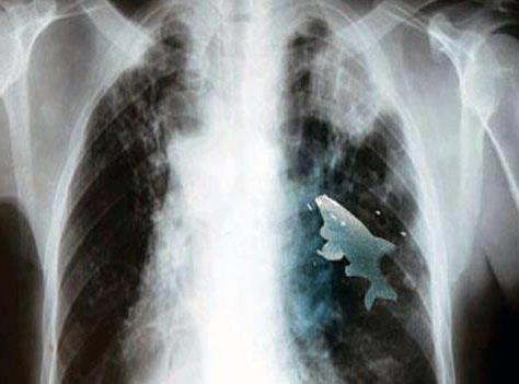 Funny fishing :) 2 - 581916439800659436643333866781n.jpg